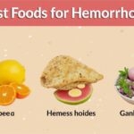 Best Food for Hemorrhoids