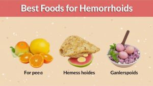 Best Food for Hemorrhoids