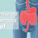 Home remedies for hemorrhoid relief